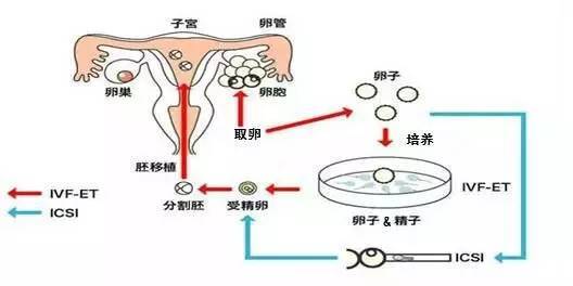 三甲医院捐卵费用统计